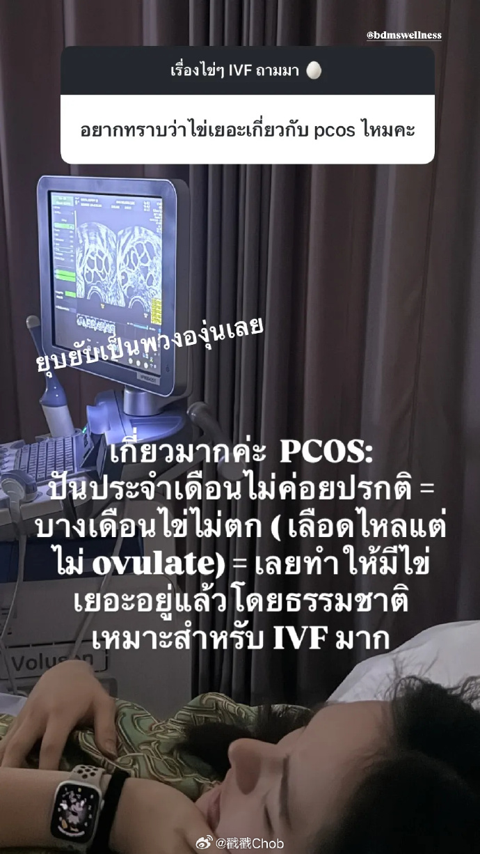 不急当妈先当“母鸡” Punpun冻卵72颗备未来