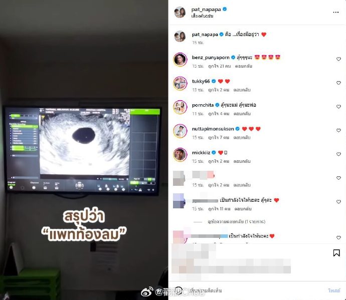 Pat Napapa分享怀孕喜讯反转 遗憾确诊“空孕囊”