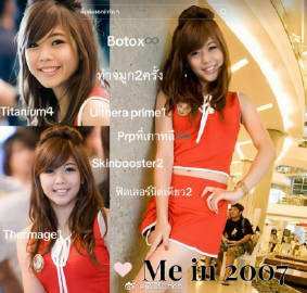 18岁 VS 37岁！Gubgib自曝“美丽成长史”