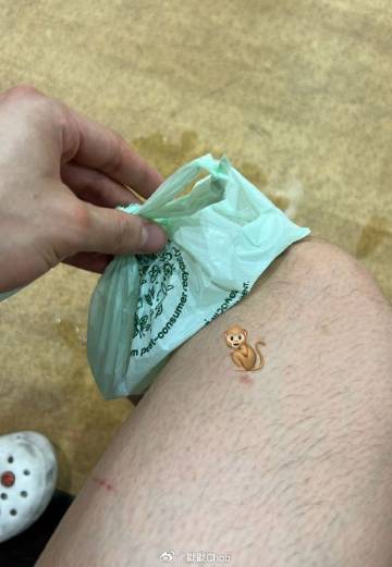 公司证实Pond Ponlawit膝盖伤情严重 需立刻开刀治疗