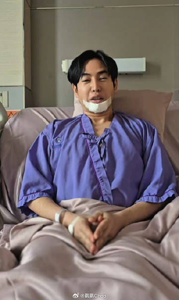 警方动用缉毒法令 Peck Palitchoke最终同意毛发毒检