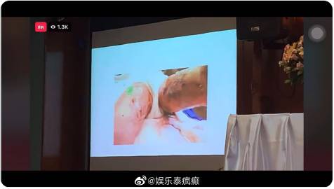 Atchariya Ruangrattanapong召开记者会指控Tangmo Nida系谋杀，抛多项证据引震动