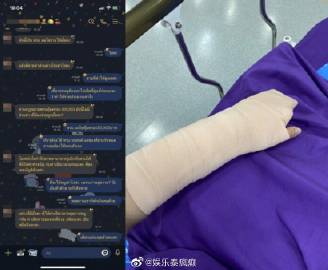 男星疑酒驾撞伤护理师引争议,受害者报警要求出面负责