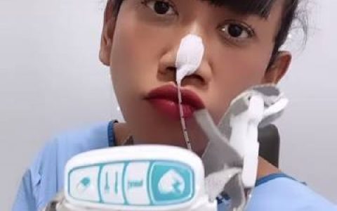 Jennie Panhan因长期胃酸倒流再赴医院检查 将进行24小时鼻胃管监测评估胃部状况