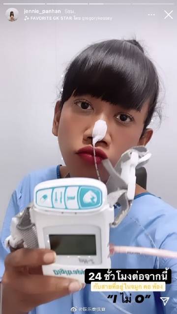 Jennie Panhan因长期胃酸倒流再赴医院检查 将进行24小时鼻胃管监测评估胃部状况