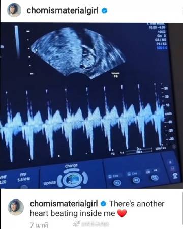 Chompoo Araya晒超声波照宣布怀孕 喜讯曝光获亲友粉丝祝福