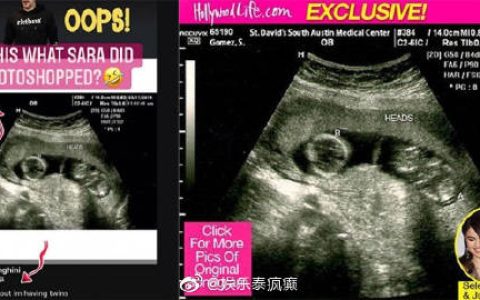 Mike前任Sarah再陷争议 录音疑爆其用假超声波照引发质疑并遭多方指控