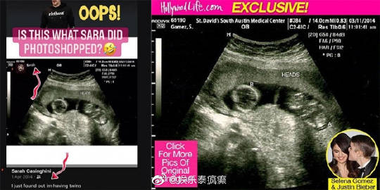 Mike前任Sarah再陷争议 录音疑爆其用假超声波照引发质疑并遭多方指控