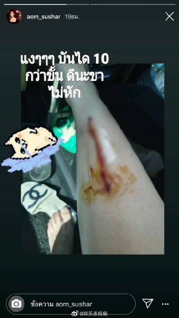 Aom Sushar拍戏意外摔落楼梯受伤坐轮椅就医发文报平安