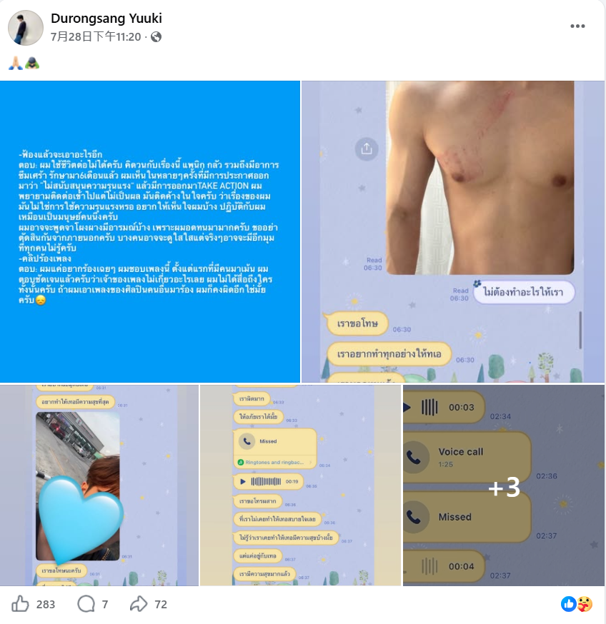Yuuki公开完整家暴始末!控诉遭前任施暴一年 两度求助经纪公司却遭无视